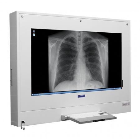 Negatoskop Cyfrowy DiCO 1M 43"