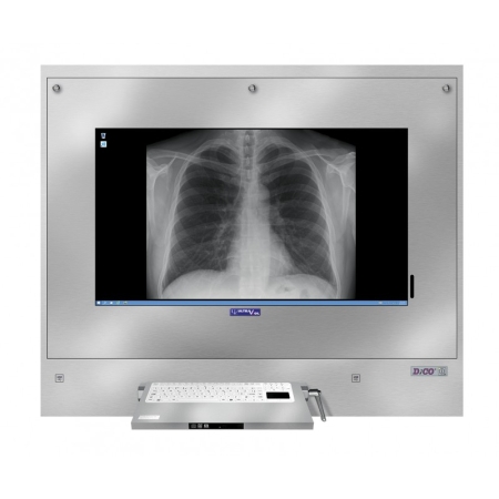 Negatoskop Cyfrowy DiCO 1M 43