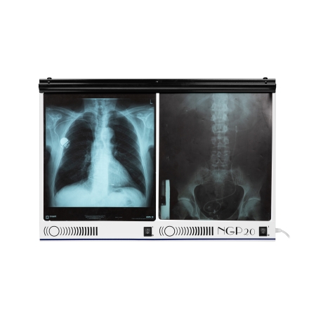 Negatoskop dwuklatkowy NGP 20 hf