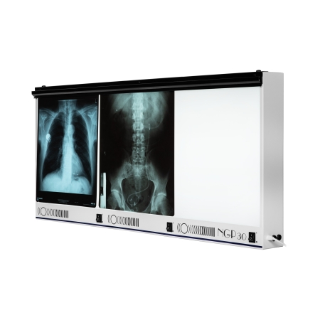 Negatoskop trzyklatkowy NGP 30 hf