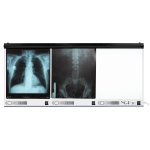 Negatoskopy wysokiej częstotliwości NGP hf