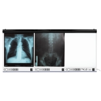 Negatoskopy wysokiej częstotliwości NGP hf