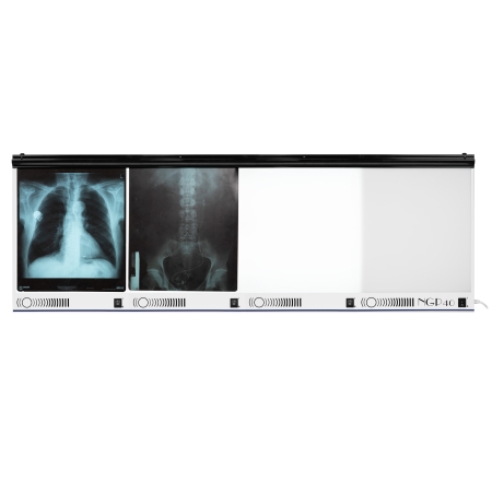 Negatoskop czteroklatkowy NGP 40 hf