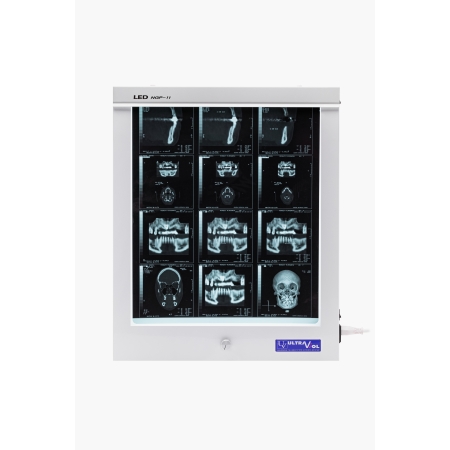Negatoskop LED NGP 11