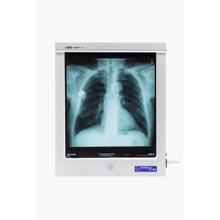 Negatoskop LED NGP 11