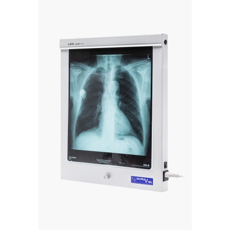 Negatoskop LED NGP 11